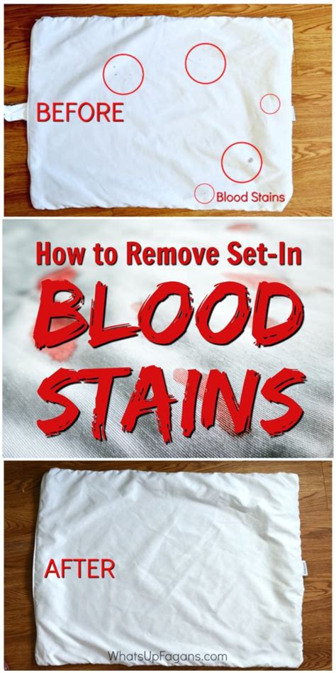 old blood stain removal clothes